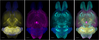 Versatile whole-organ-body staining and imaging based on electrolyte-gel properties of biological tissues