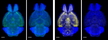 Versatile whole-organ-body staining and imaging based on electrolyte-gel properties of biological tissues