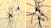 Biocytin-labeled interneurons and pyramidal neurons