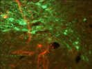 Immunofluorescent colocalization of Oxytocin and Tyrosine Hydroxylase in the Parventricular Nucleus of a steroid treated hamster