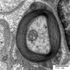 Myelinated axon cross-section