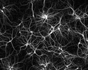 Dissociated culture of hippocampal neurons